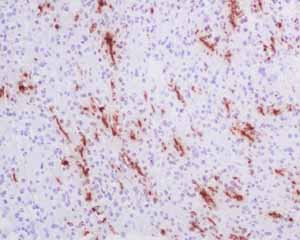Immunohistochemistry (Formalin/PFA-fixed paraffin-embedded sections) - Anti-Myelin Basic Protein antibody [EPR6652] (AB133620)