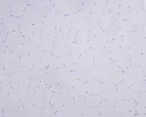 Immunohistochemistry (Formalin/PFA-fixed paraffin-embedded sections) - Anti-Myelin Basic Protein antibody [EPR6652] - BSA and Azide free (AB218542)