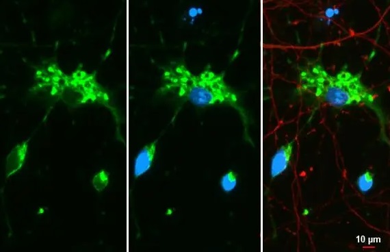 Immunocytochemistry/ Immunofluorescence - Anti-Myelin basic protein antibody [HL1033] - BSA and Azide free (ab313827), expandable thumbnail