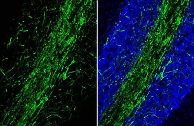 Immunohistochemistry (Frozen sections) - Anti-Myelin basic protein antibody [HL1033] - BSA and Azide free (AB313827), expandable thumbnail