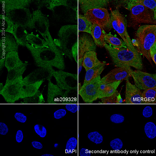 Immunocytochemistry - Anti-Myelin Basic Protein antibody [IGX3421] (ab209328), expandable thumbnail