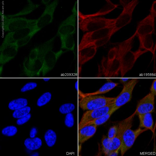 Immunocytochemistry/ Immunofluorescence - Anti-Myelin Basic Protein antibody [IGX3421] (AB209328), expandable thumbnail