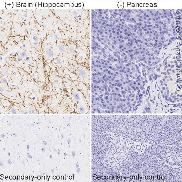 Immunohistochemistry (Formalin/PFA-fixed paraffin-embedded sections) - Anti-Myelin Basic Protein antibody [IGX3421] (AB209328), expandable thumbnail