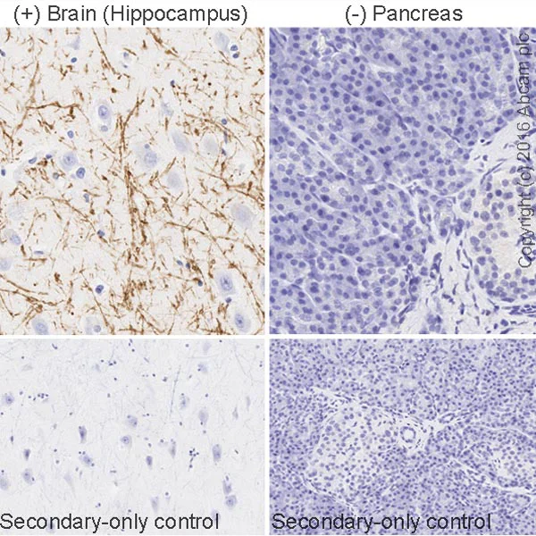 Immunohistochemistry (Formalin/PFA-fixed paraffin-embedded sections) - Anti-Myelin Basic Protein antibody [IGX3421] - BSA and Azide free (AB325974)