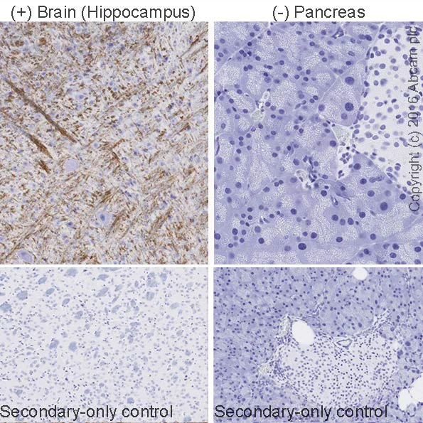 Immunohistochemistry (Formalin/PFA-fixed paraffin-embedded sections) - Anti-Myelin Basic Protein antibody [IGX3421] - BSA and Azide free (AB325974)
