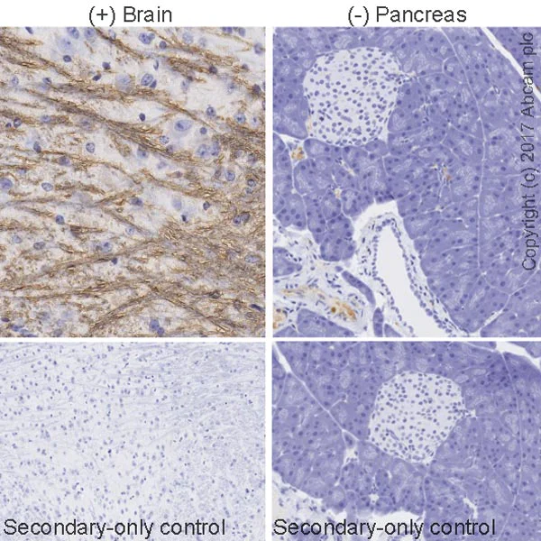 Immunohistochemistry (Formalin/PFA-fixed paraffin-embedded sections) - Anti-Myelin Basic Protein antibody [IGX3421R-1] - Oligodendrocyte Marker (AB216668)