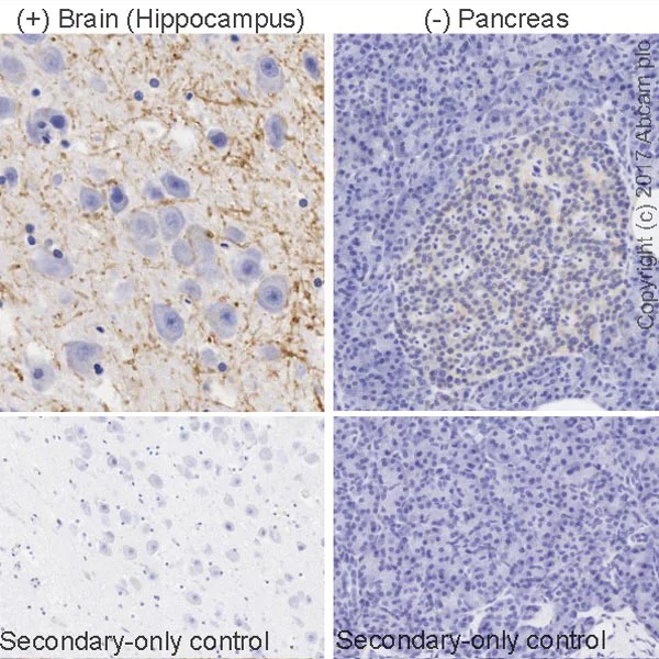 Immunohistochemistry (Formalin/PFA-fixed paraffin-embedded sections) - Anti-Myelin Basic Protein antibody [IGX3421R-1] - Oligodendrocyte Marker (AB216668)