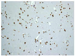 Immunohistochemistry (Formalin/PFA-fixed paraffin-embedded sections) - Anti-Myelin expression factor 2 antibody [EPR10775(B)] - BSA and Azide free (AB249911), expandable thumbnail
