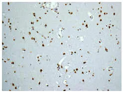 Immunohistochemistry (Formalin/PFA-fixed paraffin-embedded sections) - Anti-Myelin expression factor 2 antibody [EPR10775(B)] - BSA and Azide free (AB249911)