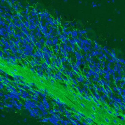Immunohistochemistry (Formalin/PFA-fixed paraffin-embedded sections) - Anti-Myelin oligodendrocyte glycoprotein antibody [CL2852] - Oligodendrocyte Marker (AB243034)