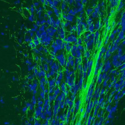 Immunohistochemistry (Formalin/PFA-fixed paraffin-embedded sections) - Anti-Myelin oligodendrocyte glycoprotein antibody [CL2852] - Oligodendrocyte Marker (AB243034)