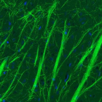 Immunohistochemistry (Formalin/PFA-fixed paraffin-embedded sections) - Anti-Myelin oligodendrocyte glycoprotein antibody [CL2852] - Oligodendrocyte Marker (AB243034)