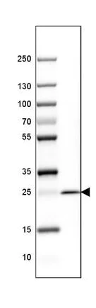 Western blot - Anti-Myelin oligodendrocyte glycoprotein antibody [CL2852] - Oligodendrocyte Marker (AB243034)
