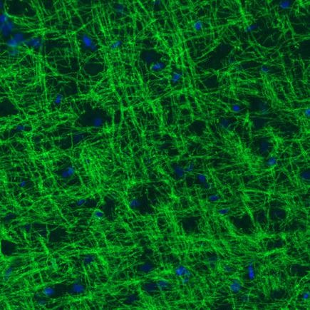 Immunohistochemistry (Formalin/PFA-fixed paraffin-embedded sections) - Anti-Myelin oligodendrocyte glycoprotein antibody [CL2858] (ab242374), expandable thumbnail