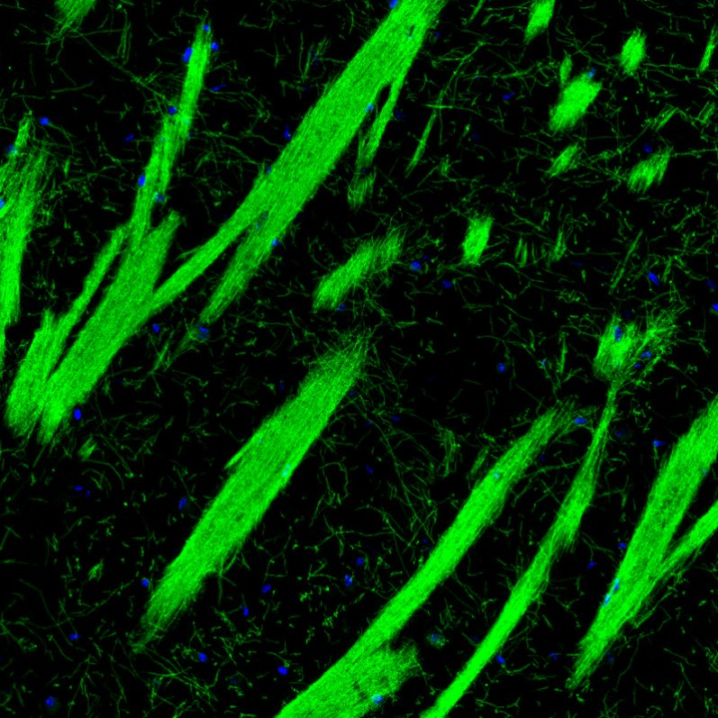 Immunohistochemistry (Formalin/PFA-fixed paraffin-embedded sections) - Anti-Myelin oligodendrocyte glycoprotein antibody [CL2858] (AB242374), expandable thumbnail