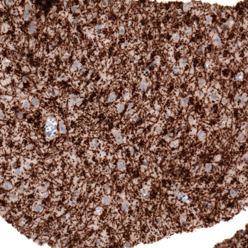 Immunohistochemistry (Formalin/PFA-fixed paraffin-embedded sections) - Anti-Myelin oligodendrocyte glycoprotein antibody [CL2858] (AB242374), expandable thumbnail