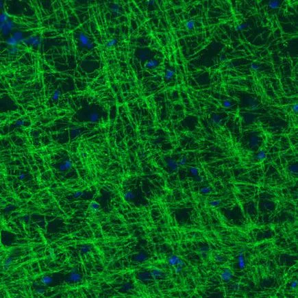 Immunohistochemistry (Formalin/PFA-fixed paraffin-embedded sections) - Anti-Myelin oligodendrocyte glycoprotein antibody [CL2858] - Oligodendrocyte Marker (AB242374)