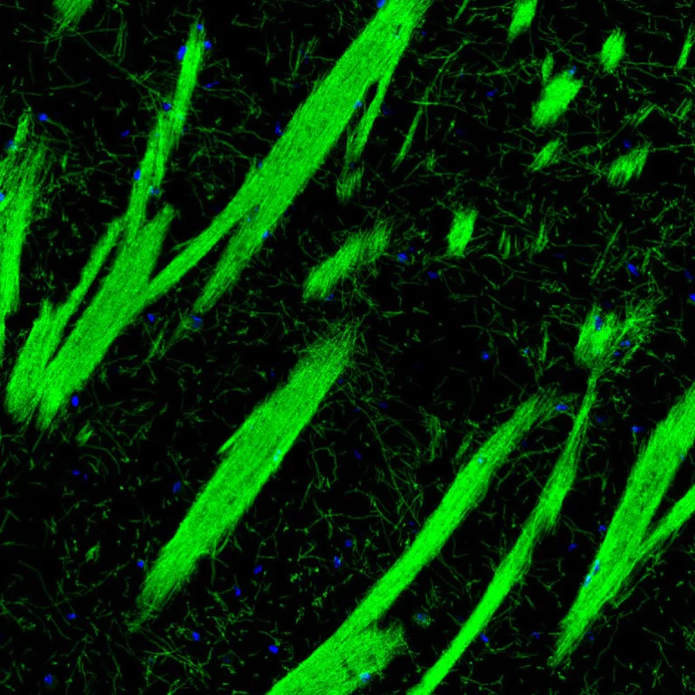 Immunohistochemistry (Formalin/PFA-fixed paraffin-embedded sections) - Anti-Myelin oligodendrocyte glycoprotein antibody [CL2858] - Oligodendrocyte Marker (AB242374)