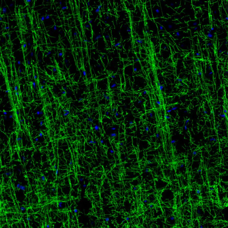 Immunohistochemistry (Formalin/PFA-fixed paraffin-embedded sections) - Anti-Myelin oligodendrocyte glycoprotein antibody [CL2858] - Oligodendrocyte Marker (AB242374)