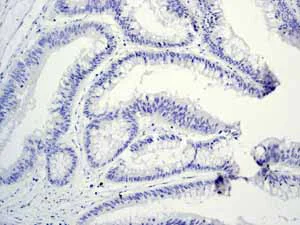 Immunohistochemistry (Formalin/PFA-fixed paraffin-embedded sections) - Anti-Myelin oligodendrocyte glycoprotein antibody [EP4281] - BSA and Azide free (AB233025)