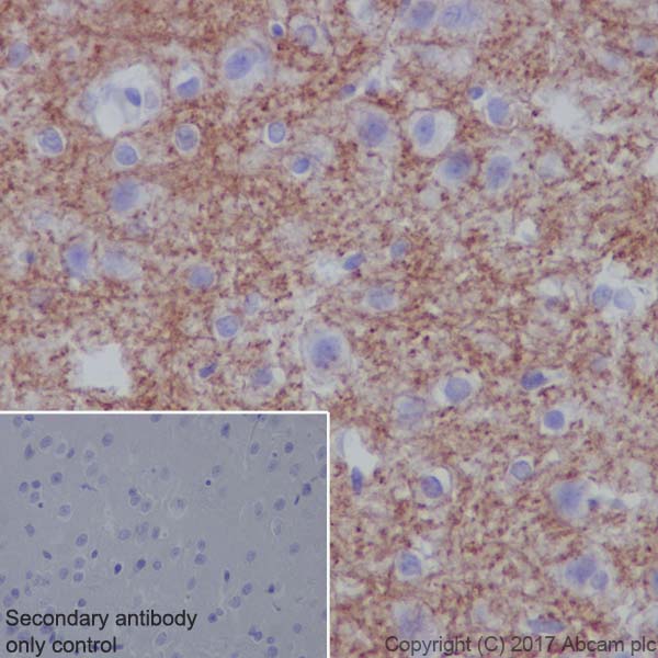 Anti-Myelin oligodendrocyte glycoprotein antibody [EP4281] - Oligodendrocyte Marker