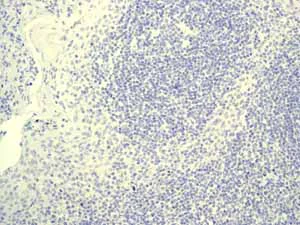 Immunohistochemistry (Formalin/PFA-fixed paraffin-embedded sections) - Anti-Myelin oligodendrocyte glycoprotein antibody [EP4281] - Oligodendrocyte Marker (AB109746)