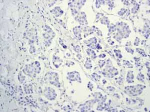 Immunohistochemistry (Formalin/PFA-fixed paraffin-embedded sections) - Anti-Myelin oligodendrocyte glycoprotein antibody [EP4281] - Oligodendrocyte Marker (AB109746)