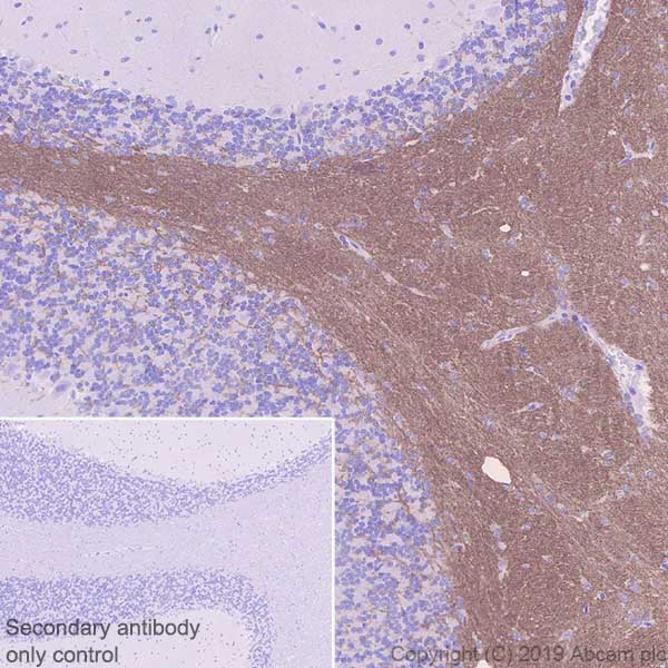 Immunohistochemistry (Formalin/PFA-fixed paraffin-embedded sections) - Anti-Myelin oligodendrocyte glycoprotein antibody [EPR22629-310] (AB233549), expandable thumbnail