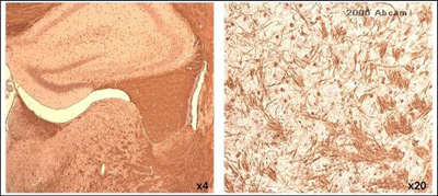 Immunohistochemistry (Formalin/PFA-fixed paraffin-embedded sections) - Anti-Myelin PLP antibody (AB28486)