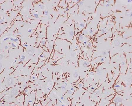 Immunohistochemistry (Formalin/PFA-fixed paraffin-embedded sections) - Anti-Myelin PLP antibody [EPR12675(2)(B)] (AB183493)