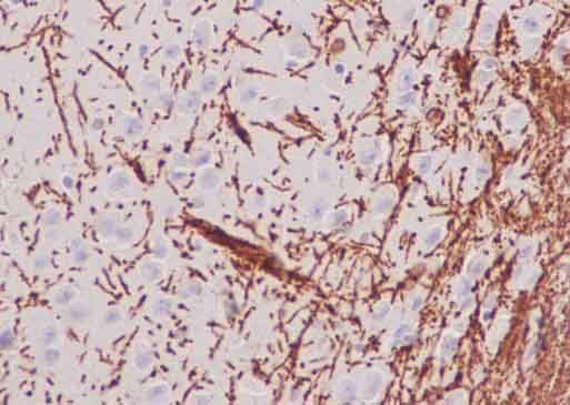 Immunohistochemistry (Formalin/PFA-fixed paraffin-embedded sections) - Anti-Myelin PLP antibody [EPR12675(2)(B)] - BSA and Azide free (AB250654), expandable thumbnail