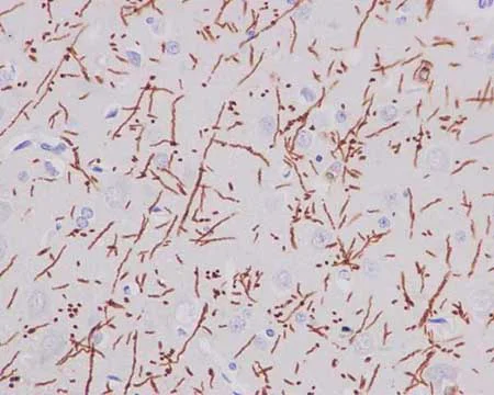 Immunohistochemistry (Formalin/PFA-fixed paraffin-embedded sections) - Anti-Myelin PLP antibody [EPR12675(2)(B)] - BSA and Azide free (AB250654)