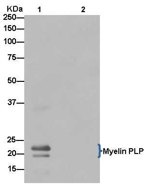Immunoprecipitation - Anti-Myelin PLP antibody [EPR12675(2)(B)] - BSA and Azide free (AB250654), expandable thumbnail