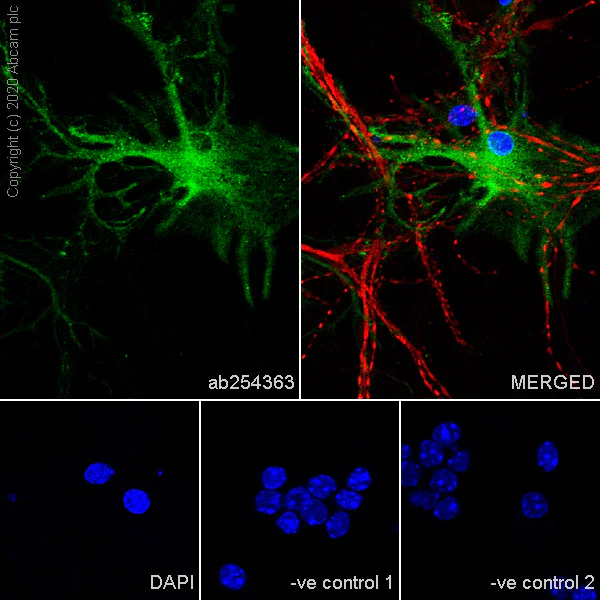 Immunocytochemistry/ Immunofluorescence - Anti-Myelin PLP antibody [EPR23504-106] (AB254363)