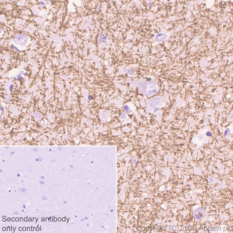 Immunohistochemistry (Formalin/PFA-fixed paraffin-embedded sections) - Anti-Myelin PLP antibody [EPR23504-106] (ab254363), expandable thumbnail