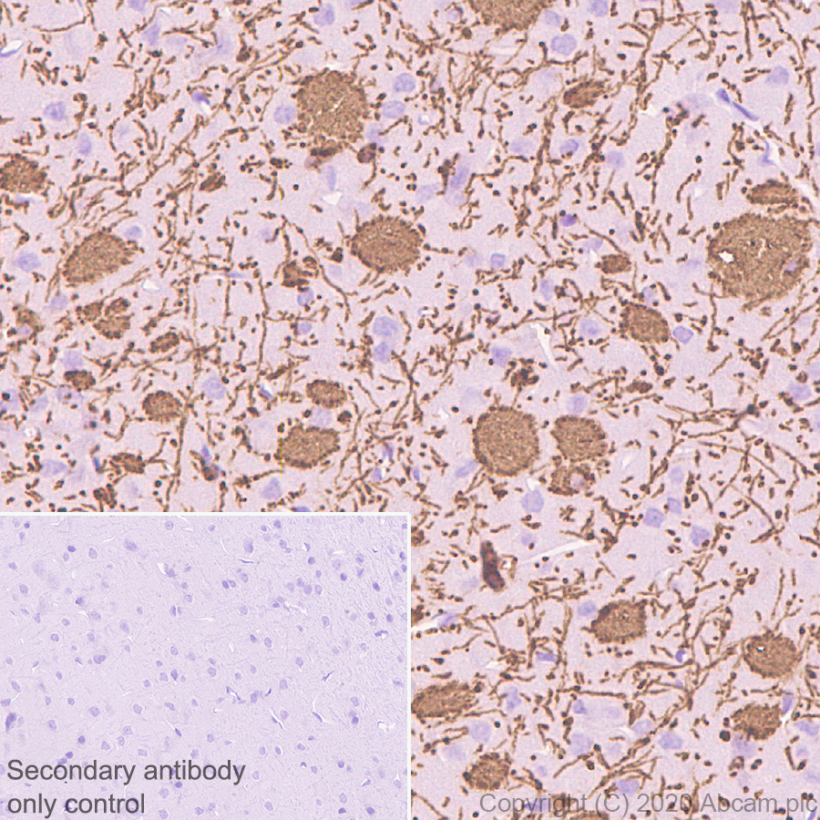 Immunohistochemistry (Formalin/PFA-fixed paraffin-embedded sections) - Anti-Myelin PLP antibody [EPR23504-106] (ab254363), expandable thumbnail