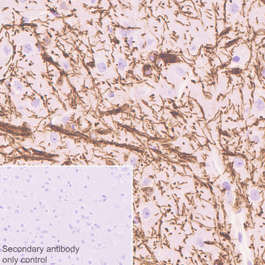 Immunohistochemistry (Formalin/PFA-fixed paraffin-embedded sections) - Anti-Myelin PLP antibody [EPR23504-106] (AB254363), expandable thumbnail