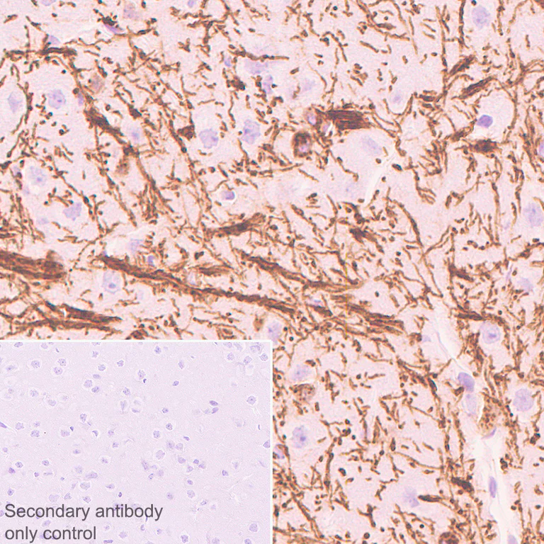 Immunohistochemistry (Formalin/PFA-fixed paraffin-embedded sections) - Anti-Myelin PLP antibody [EPR23504-106] (AB254363)