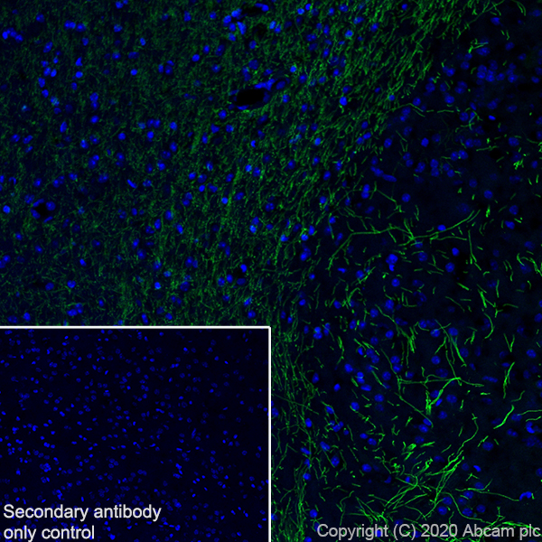 Immunohistochemistry (Frozen sections) - Anti-Myelin PLP antibody [EPR23504-106] (ab254363), expandable thumbnail