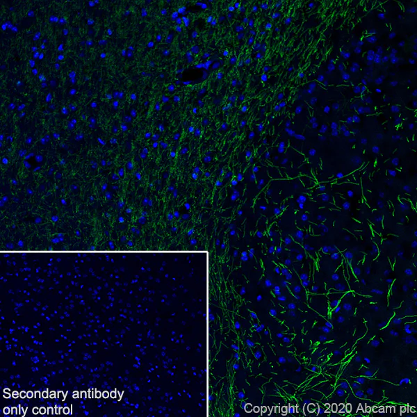 Immunohistochemistry (Frozen sections) - Anti-Myelin PLP antibody [EPR23504-106] (AB254363)