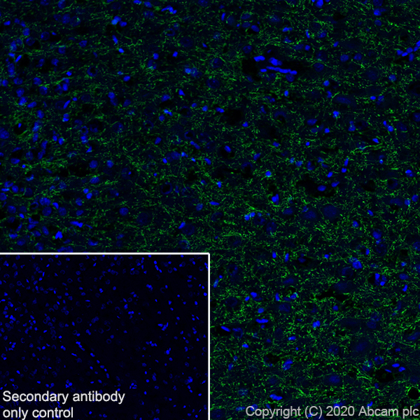 Immunohistochemistry (Frozen sections) - Anti-Myelin PLP antibody [EPR23504-106] (ab254363), expandable thumbnail