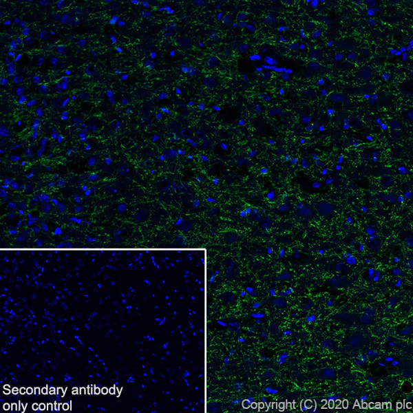 Immunohistochemistry (Frozen sections) - Anti-Myelin PLP antibody [EPR23504-106] (AB254363)