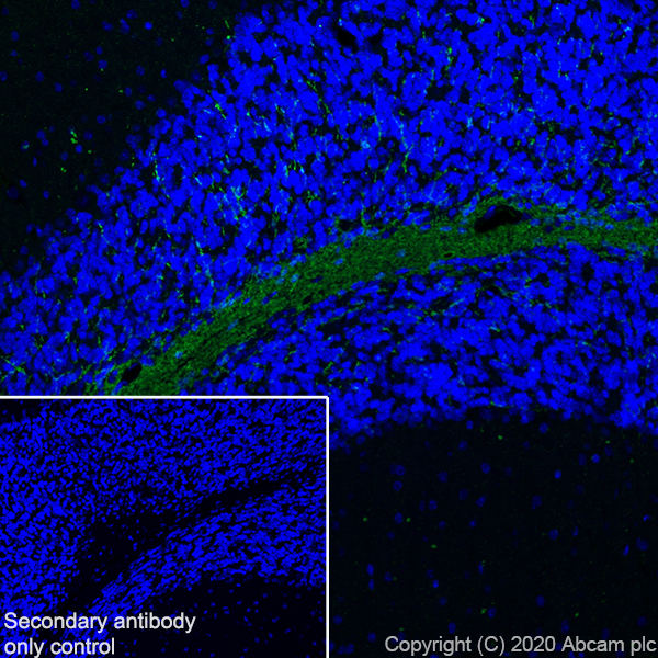Immunohistochemistry (Frozen sections) - Anti-Myelin PLP antibody [EPR23504-106] (ab254363), expandable thumbnail