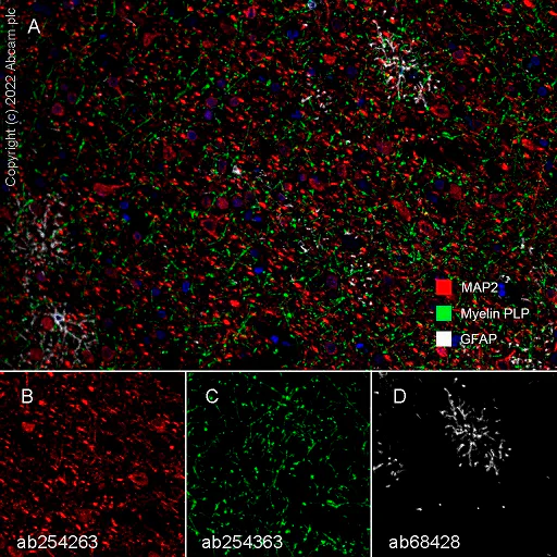 Multiplex immunohistochemistry - Anti-Myelin PLP antibody [EPR23504-106] (AB254363)