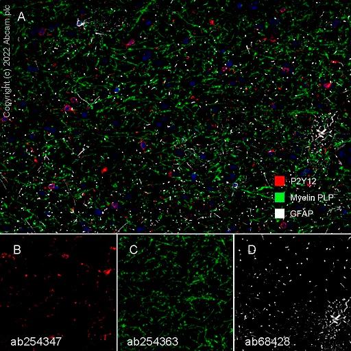 Multiplex immunohistochemistry - Anti-Myelin PLP antibody [EPR23504-106] (AB254363)