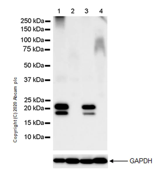 Western blot - Anti-Myelin PLP antibody [EPR23504-106] (AB254363)