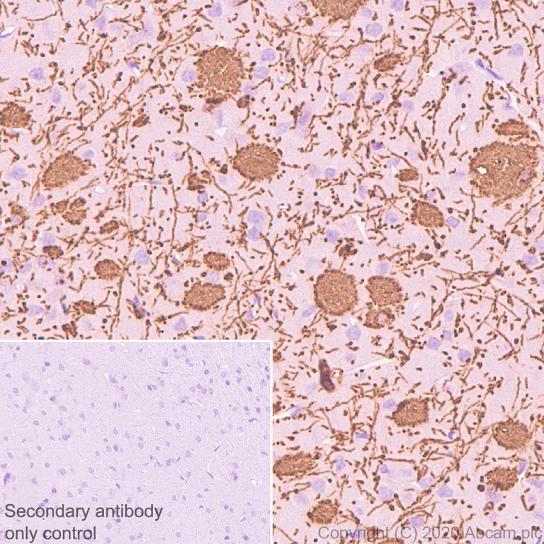 Immunohistochemistry (Formalin/PFA-fixed paraffin-embedded sections) - Anti-Myelin PLP antibody [EPR23504-106] - BSA and Azide free (AB275751)