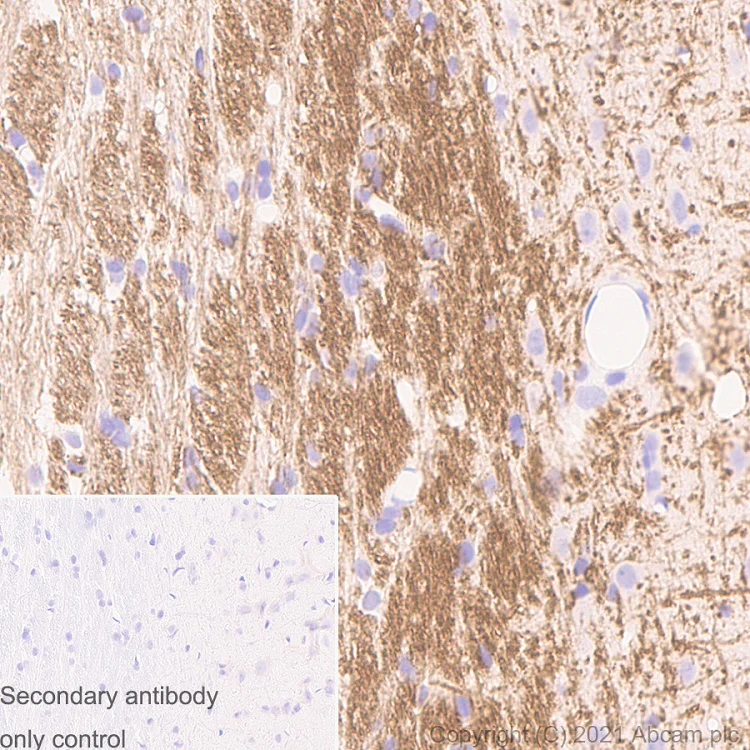 Immunohistochemistry (Formalin/PFA-fixed paraffin-embedded sections) - Anti-Myelin PLP antibody [plpc 1] (AB9311)