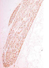 Immunohistochemistry (PFA perfusion fixed frozen sections) - Anti-Myelin Protein Zero antibody (AB134439)