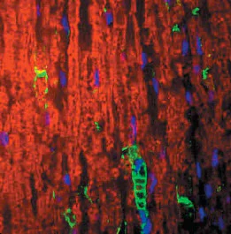 Immunohistochemistry (PFA perfusion fixed frozen sections) - Anti-Myelin Protein Zero antibody (AB134439)